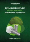 Dieta i suplementacja przy wszczepieniu implantów zębowych - ebook